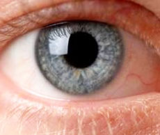 Preventing cataracts