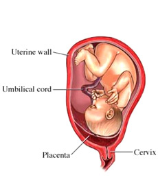 Gestational Diabetes: Causes, Symptoms and Management