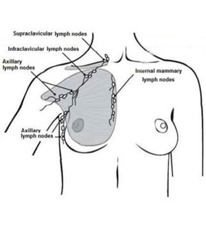 Understanding Cancer