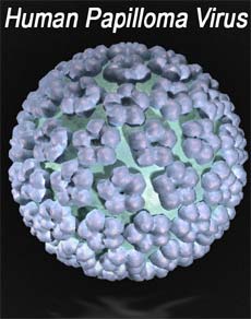 What is Cervical Cancer