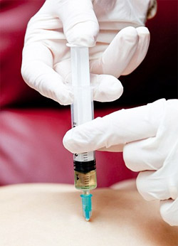 Silicon Buttock Injections: Banned, Yet Available