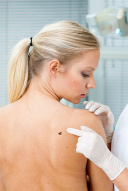 Top 10 Deadly Myths About Skin Cancer