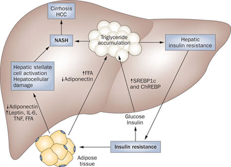 Non-Alcoholic Fatty Liver Disease (NAFLD): Symptoms & Treatment