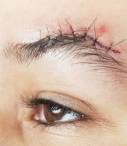 Scar Prevention: Dos and Don’ts