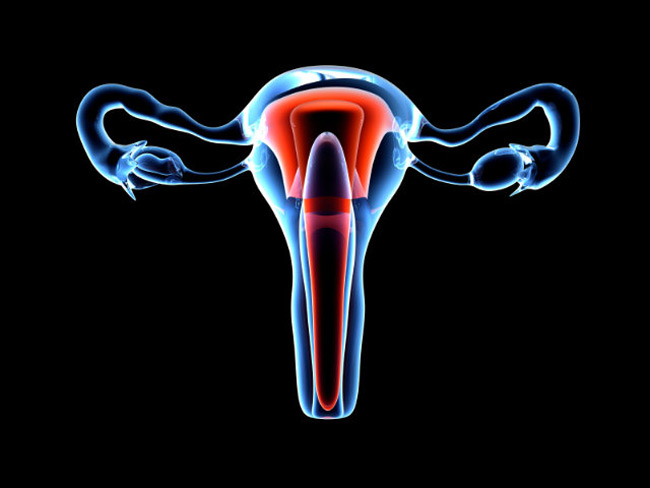 Uterine Factor Infertility (UFI)   