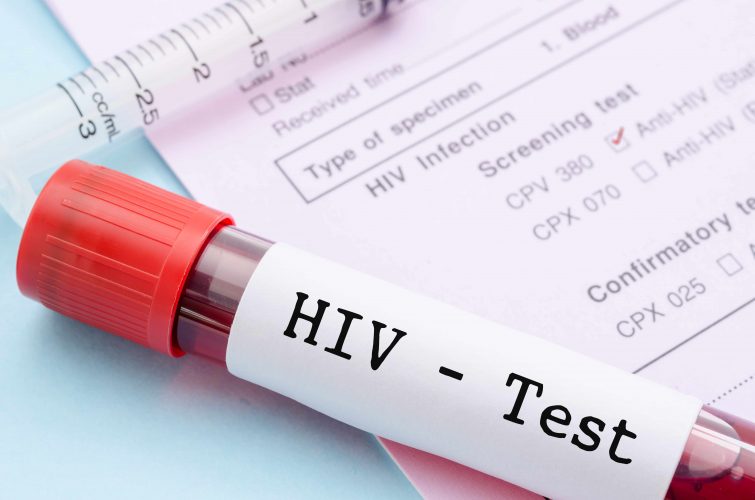 HIV Myths