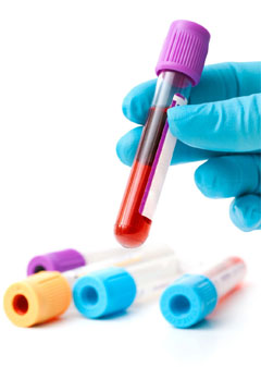 Updated Guidelines by the HIV Medicine Association