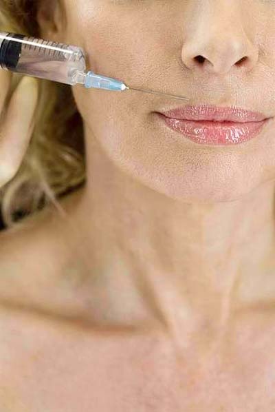 Baby Drop Fillers - Top 10 Beauty Treatments done by Celebrities Before the Oscars Baby Drop Fillers - Top 10 Beauty Treatments done by Celebrities Before the Oscars