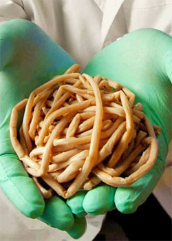 Tapeworm Diet: An Extremely Risky Weight Loss Method