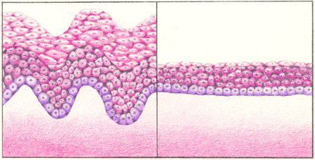 New Menopausal Symptom Management Guidelines 2014