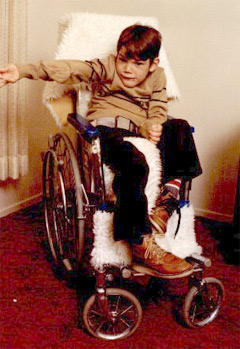  Lesch�Nyhan syndrome