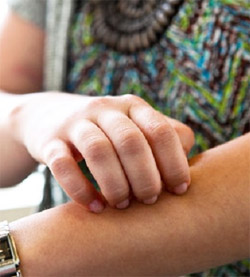 Urticaria: A Distressing Disorder