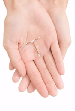 IUDs: Birth Control Option for Teenagers
