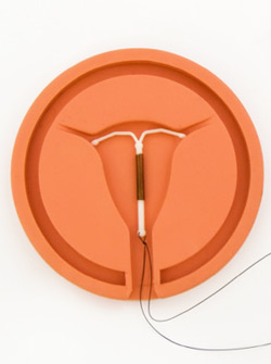 IUDs: Birth Control Option for Teenagers