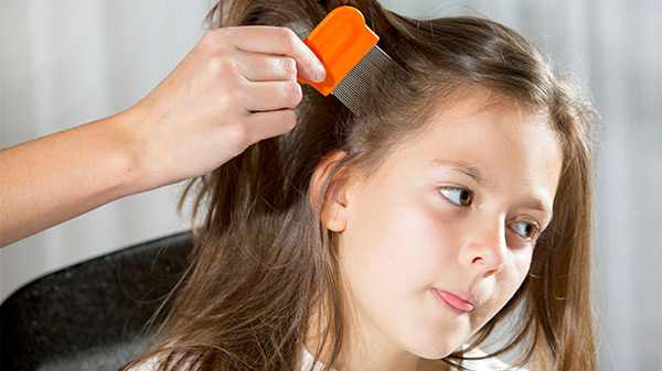Hair Care Tips to Prevent Lice