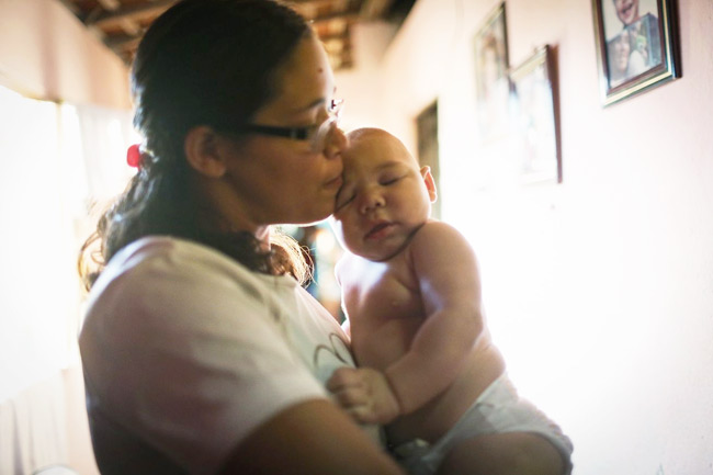 Zika Virus: High Alert for Pregnant Women 