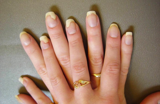 Potential Hazards Of Acrylic Nails