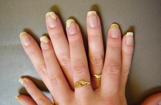 Potential Hazards of Acrylic Nails  