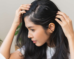 Herbal Treatment for Alopecia