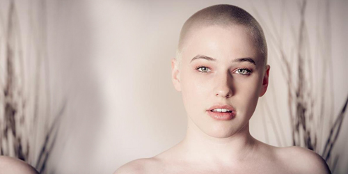 Alopecia Awareness Month