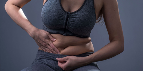 Loose Skin after Weight Loss