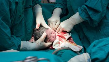 C-SECTION