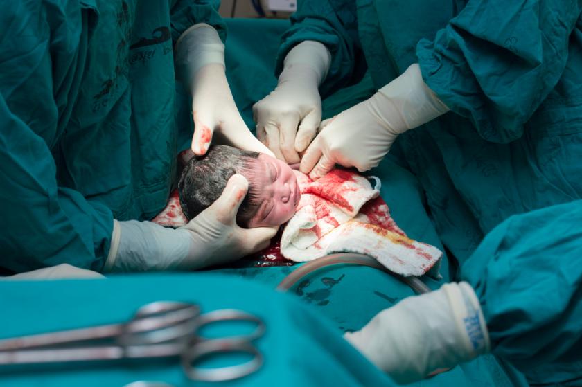 C-SECTION