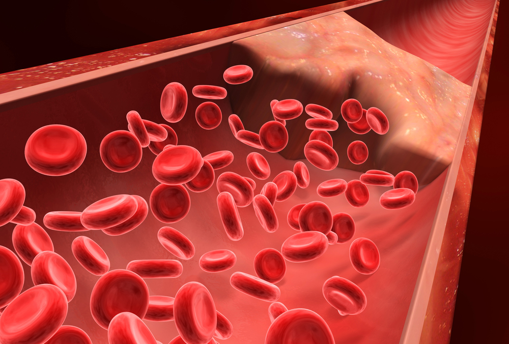 Nanoparticles That Speed Blood Clotting May Oneday Save Lives - Women
