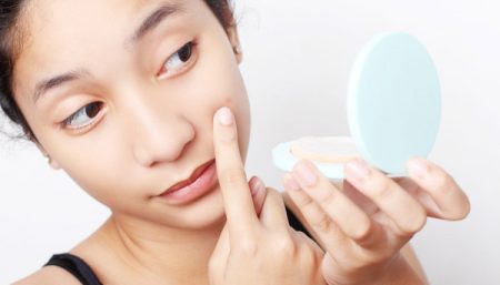 treating acne