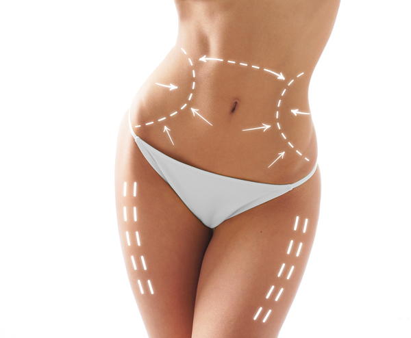 Cryolipolysis
