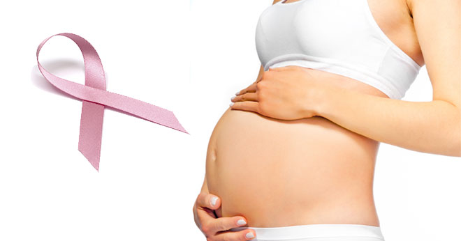 Pregnancy & Breast Cancer: Know It All - Women Fitness