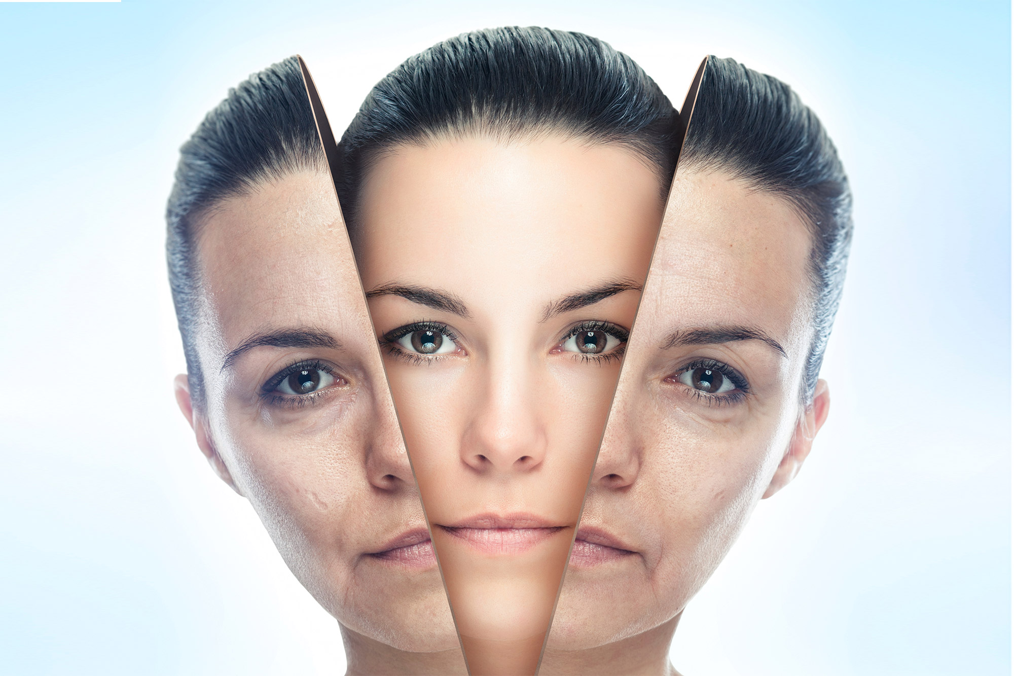 Skin Resurfacing - Opting For Chemical Peel - Women Fitness