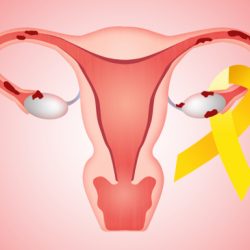 Endometriosis experts