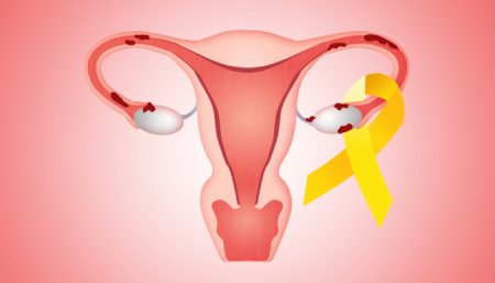 Endometriosis experts