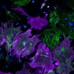 How to turn damaged heart tissue back into healthy heart muscle: New details emerge