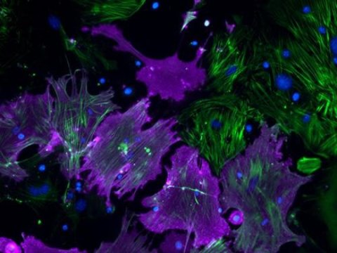 How to turn damaged heart tissue back into healthy heart muscle: New details emerge