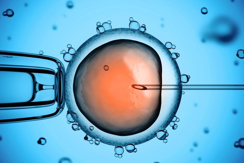 Does timing of IVF to avoid weekend