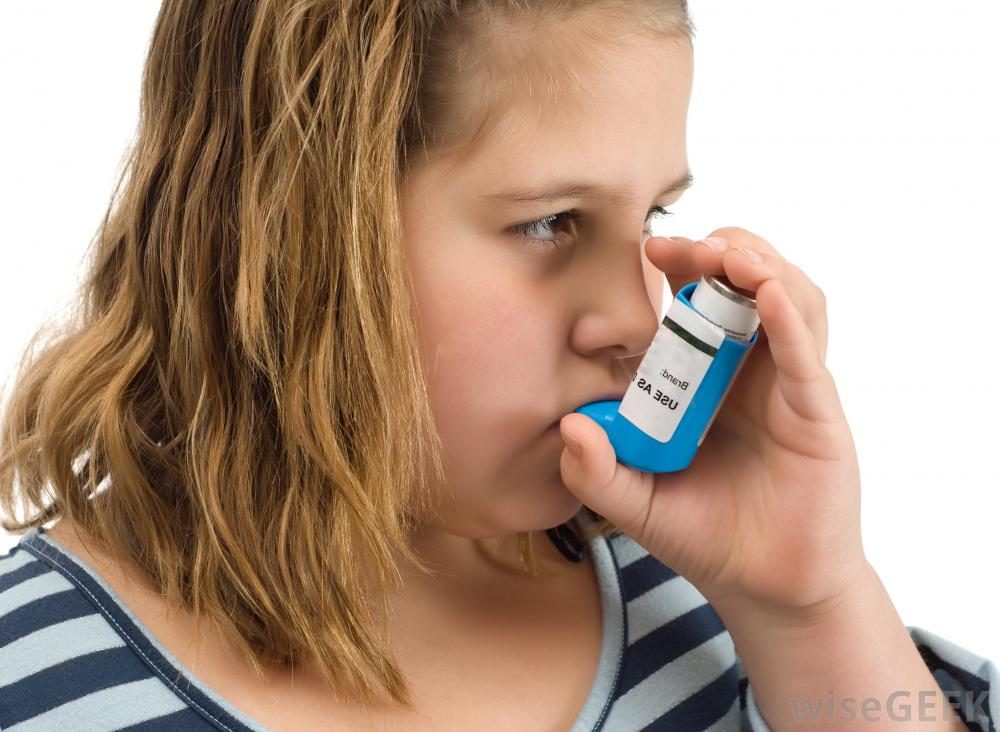 Obesity: a risk factor for Asthma