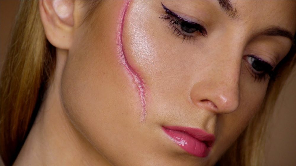 Top 10 Risks of Cosmetic Surgery Women Fitness