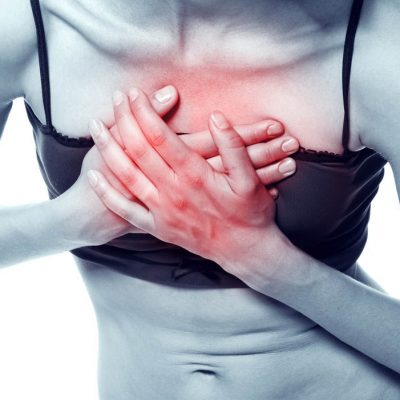 Heart attack