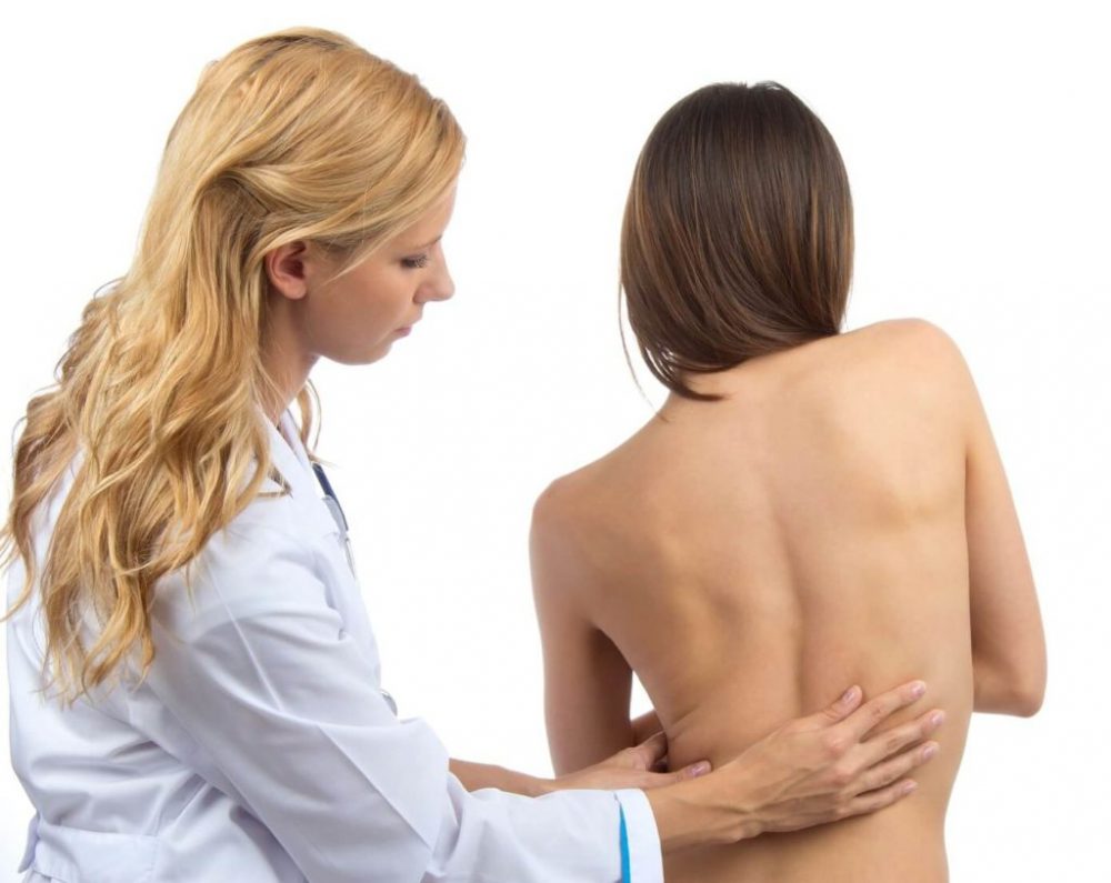 Scoliosis