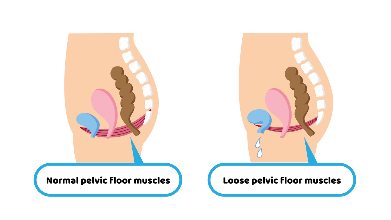 Pelvic floor back pain