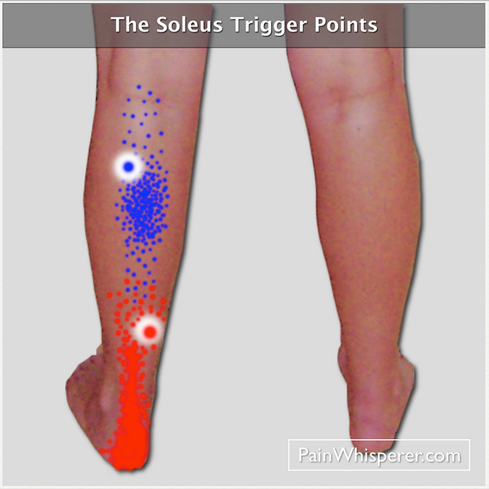 BabieBlue Trigger Point Therapy for Calf, Ankle & Foot Pain