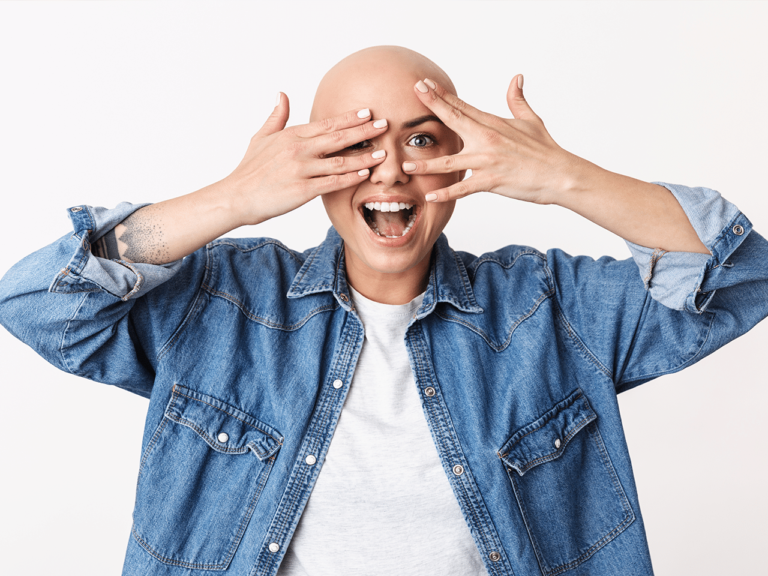Can Bald People Get Lice? Women Fitness