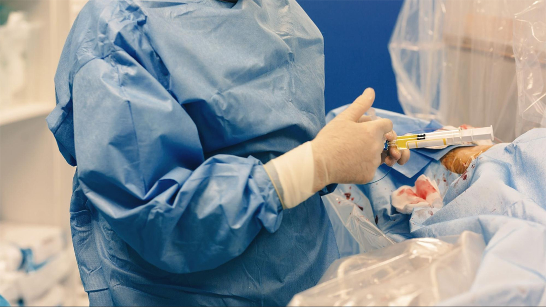 Uterine Fibroid Embolization