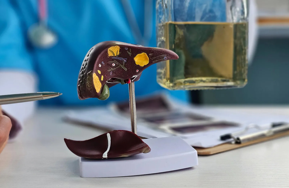 Link Between Alcohol and Liver Disease