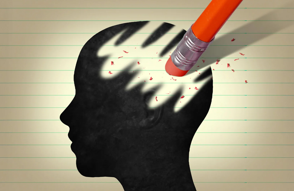 Alzheimer